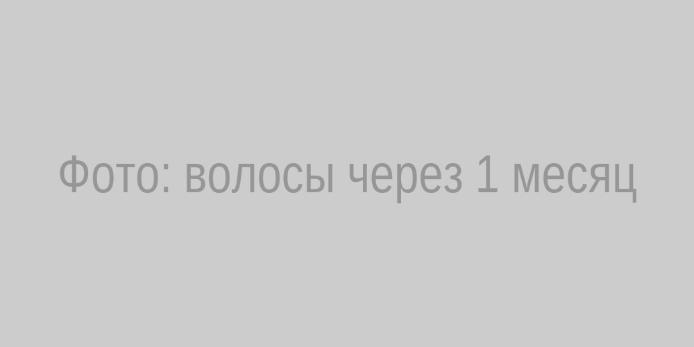 Шоковое выпадение волос через месяц
