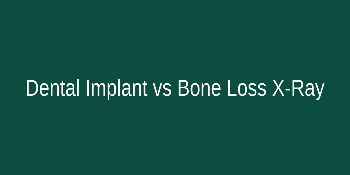 Comparison X-ray showing severe bone resorption in untreated gaps versus preserved bone density with dental implants in Kanpur