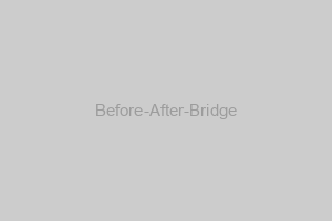 Before After Bridge