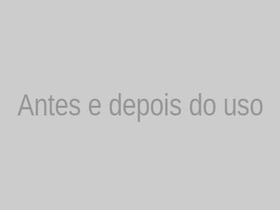 Antes e Depois Hidrabene