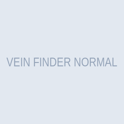 VEIN FINDER NORMAL