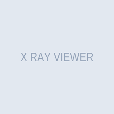 X RAY VIEWER