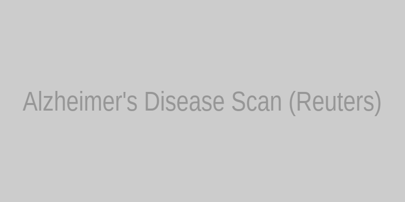 Alzheimer's disease scan (Reuters)